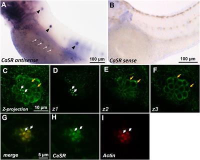 Role of Calcium-Sensing Receptor in Mechanotransducer-Channel-Mediated Ca2+ Influx in Hair Cells of Zebrafish Larvae